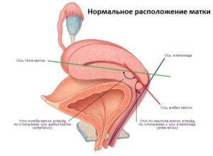 Матка отклонена кпереди