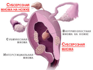 Интерстициальный узел что это такое