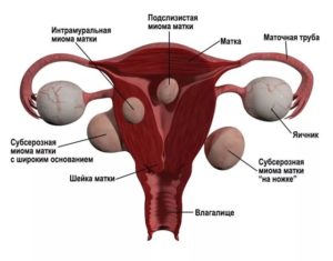 Почему болит матка в середине цикла