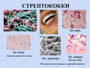 Streptococcus mitis что это такое