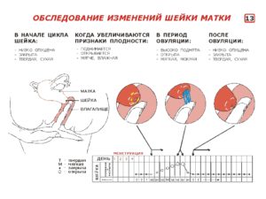 Какая матка перед месячными на ощупь