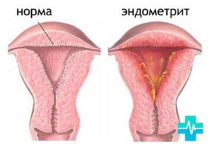 Неприятный запах при месячных причины