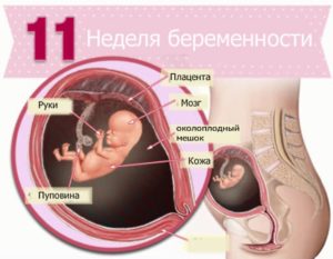 11 неделя беременности