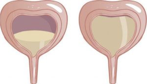 Постоянное ощущение полного мочевого пузыря у женщин