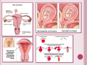 Воспаление в матке причины