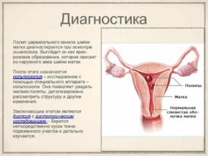 Что такое цервикальный канал и шейка матки