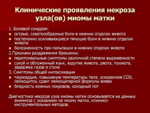 Как распознать признаки миомы матки