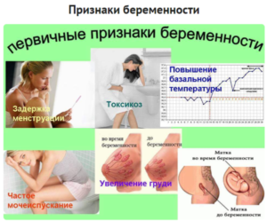 Задержка месячных и частое мочеиспускание