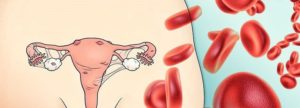 Как остановить кровотечение при эндометриозе