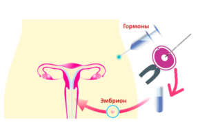 Эко при мужском бесплодии