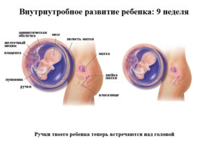 9 недель беременности