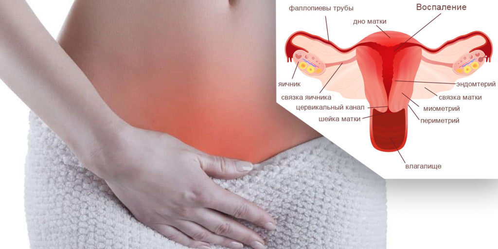 Воспаление в матке причины