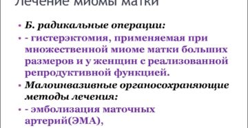 Современные методы лечения миомы матки