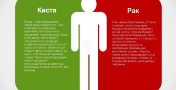 Чем отличается киста от опухоли