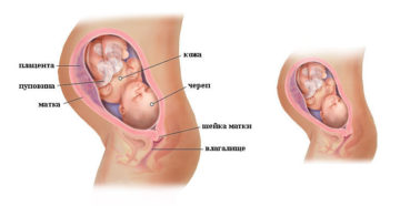 32 неделя беременности