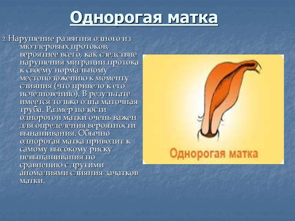 Что означает однорогая матка