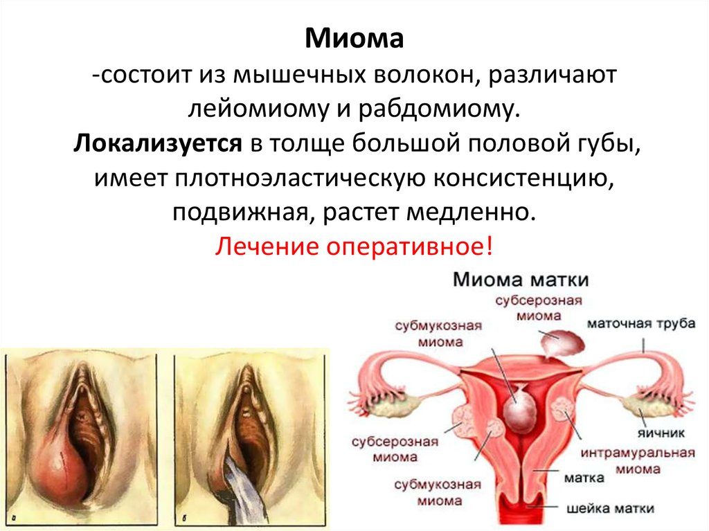 Опухла половая губа при беременности