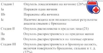 Рак яичников 3, 4 стадия: сколько живут с асцитом