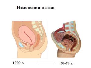 Как сократить матку после родов и кесарева