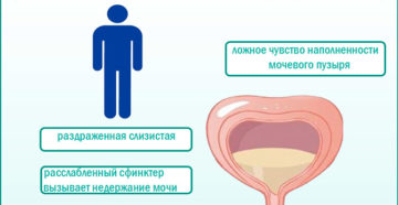 Ощущение наполненности мочевого пузыря у женщин