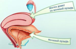Матка давит на мочевой пузырь