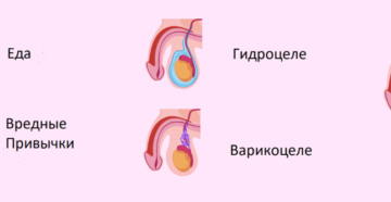 Гидроцеле осумкованное что это