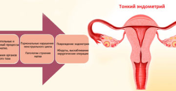 Причины тонкого эндометрия матки