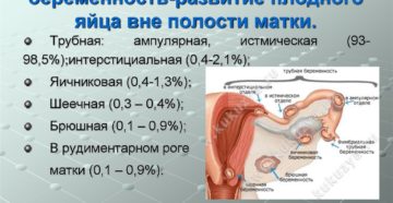 Эктопическая беременность что это такое