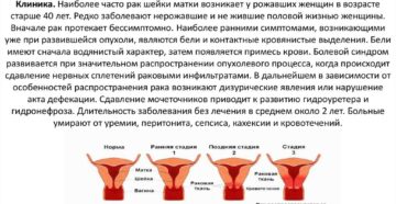 Как определить рак шейки матки