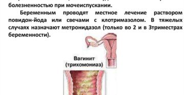 Трихомонадный кольпит симптомы и лечение у мужчин