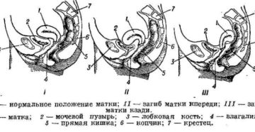 Поза для зачатия при загибе матки кзади