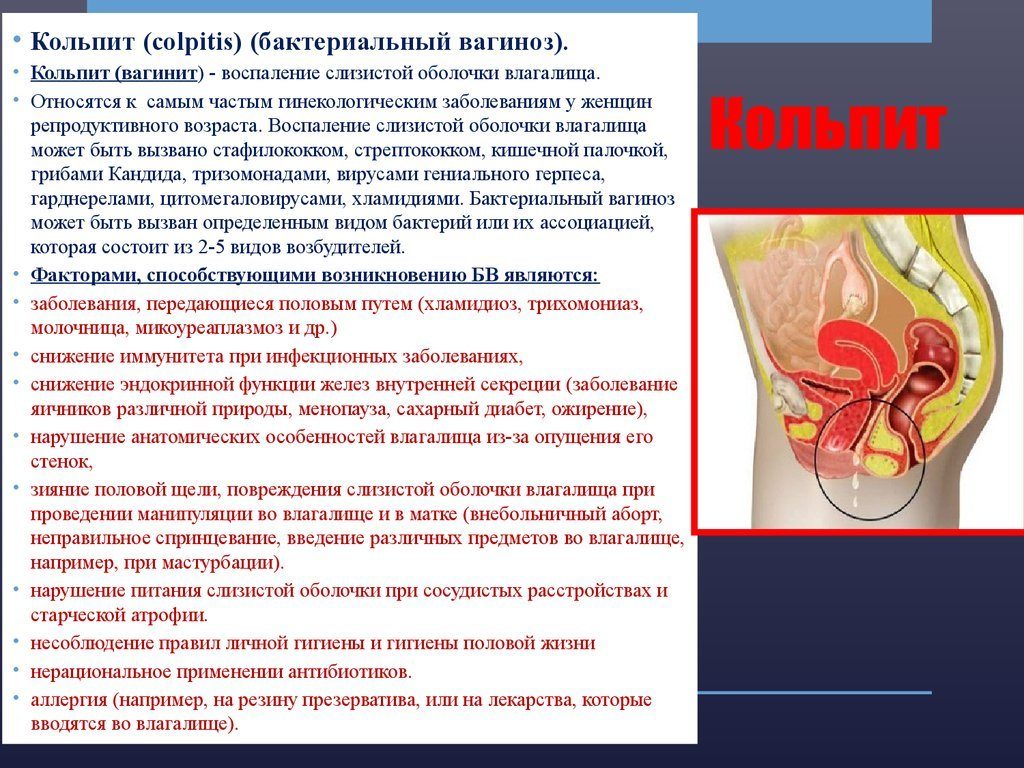 Возрастной кольпит у женщин лечение