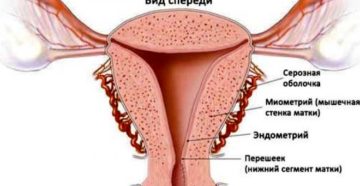 Тонкие стенки матки
