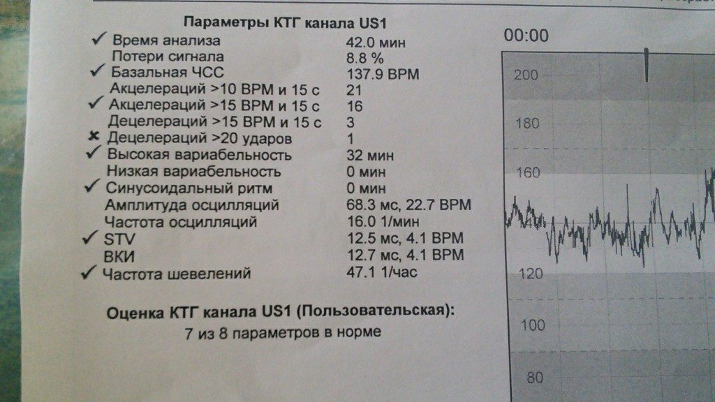 Сколько по времени делают ктг при беременности