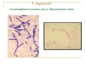 Полиморфные палочки в мазке что это