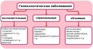 Профилактика гинекологических заболеваний у женщин