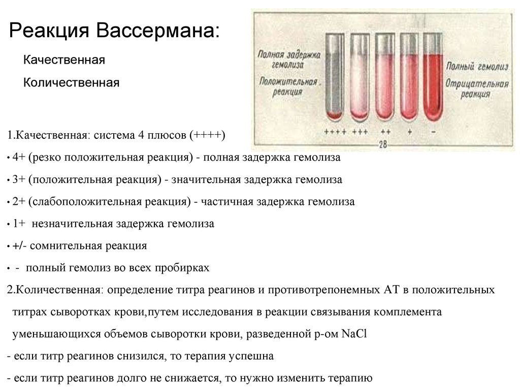 Реакция вассермана положительная при каких заболеваниях