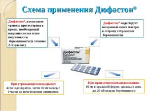 Как принимать Дюфастон при бесплодии