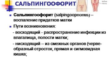 Хронический сальпингоофорит (воспаление придатков): признаки, как лечить