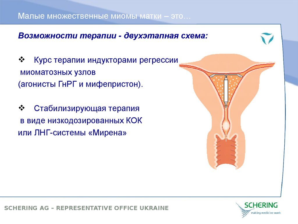 Лечение множественной миомы матки