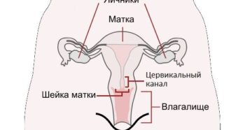 Цервикальный канал сомкнут что это