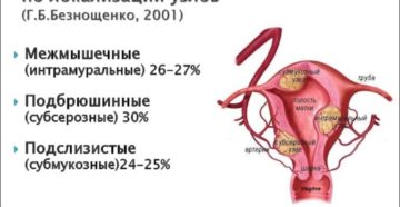 Чем лейомиома матки отличается от миомы