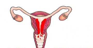 Перед месячными болит матка