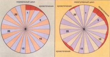 Нерегулярные месячные у подростка