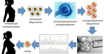 Генетический анализ эмбриона при эко