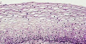 Гистология шейки матки