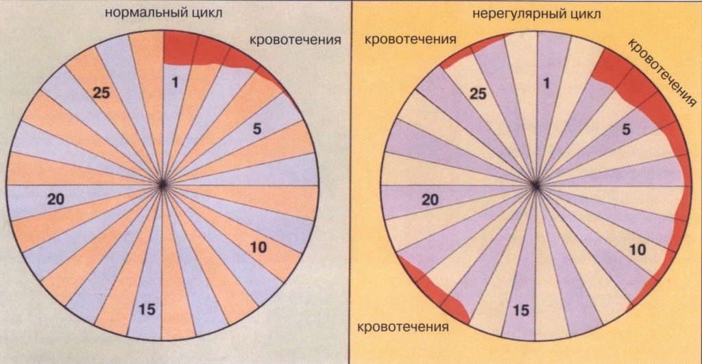 Нерегулярные месячные причины