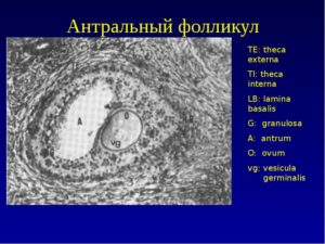 Антральные фолликулы в яичниках что это такое