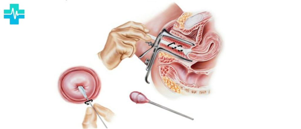 Мазок на цитологию как берут