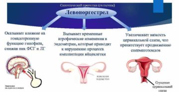 Левоноргестрел влияние на организм женщины